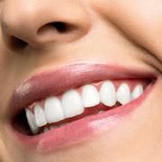 A Comprehensive Guide to Teeth Whitening in Newark